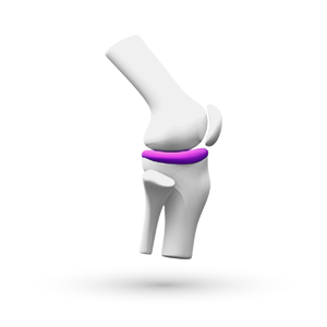 Informācija par sāpēm un osteoartrītu